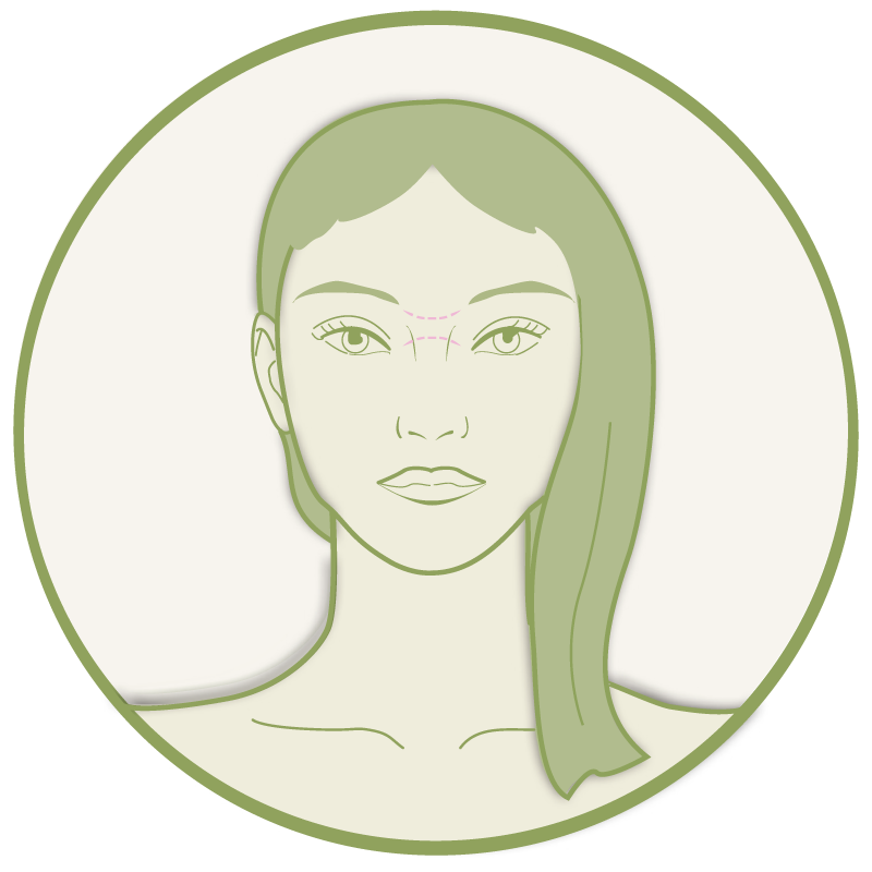 Bunnylines – Platzhalter