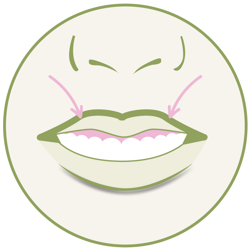 Gummy Smile – Platzhalter