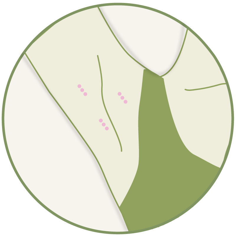 Anti-Schwitz-Spritze – Platzhalter