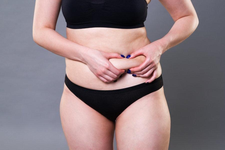 Bauchdecken­straffung: Mittels Abdominoplastik den Bauch straffen