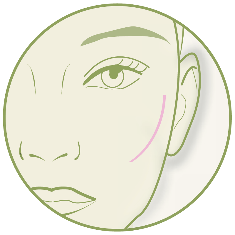 Wangenknochen – Platzhalter