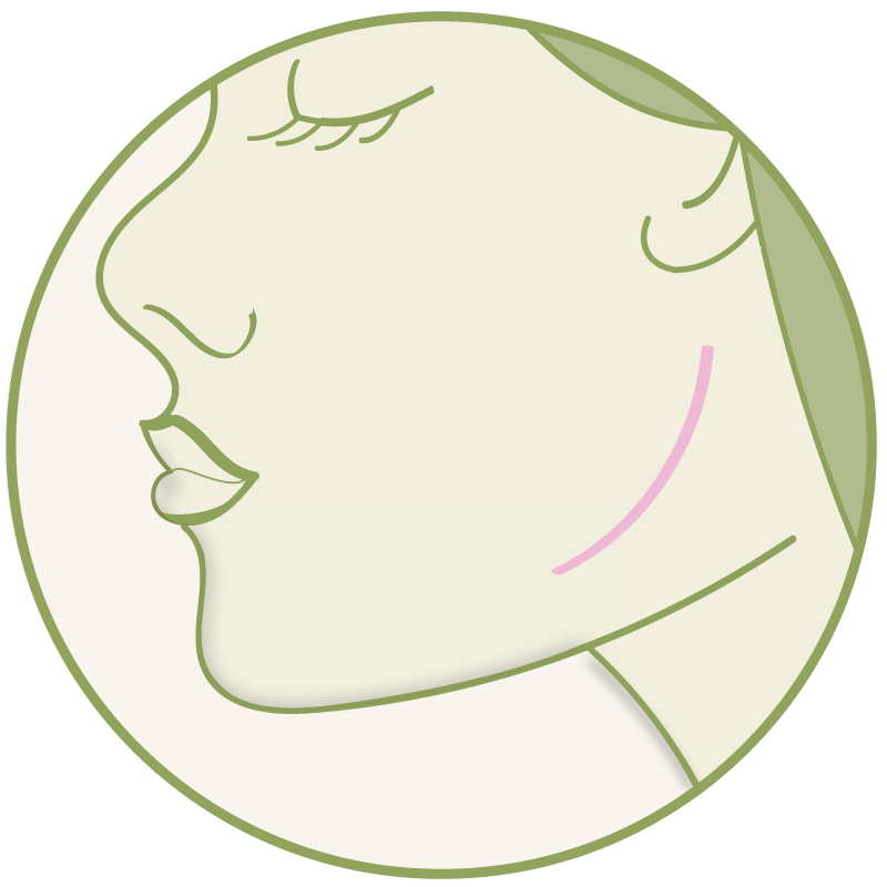 Jawline – Platzhalter