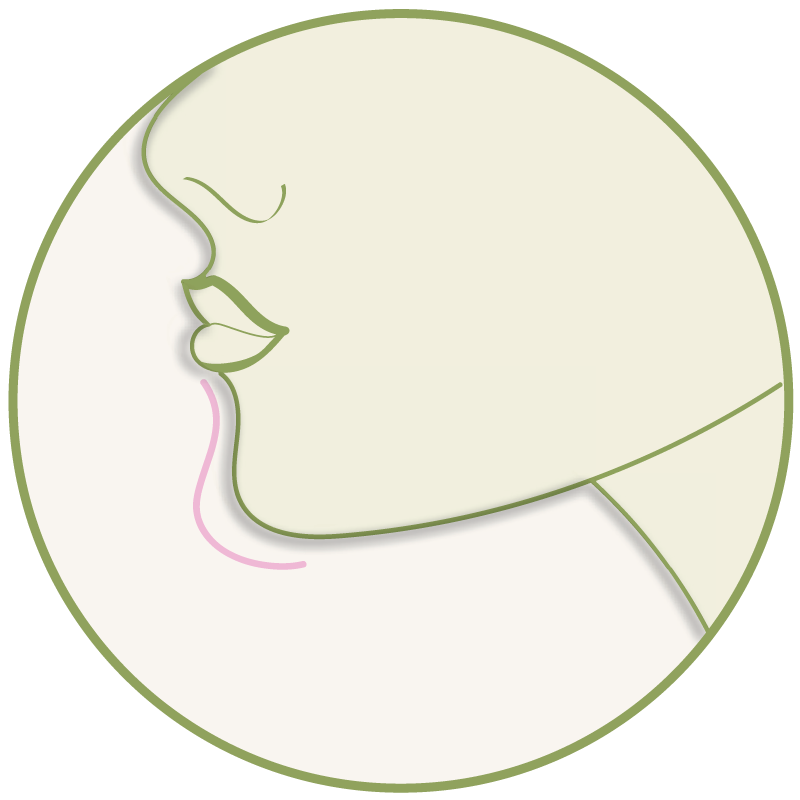 Kinnaufbau – Platzhalter