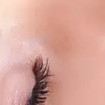 images uploads 2013 04 plastische chirurgie 150x150