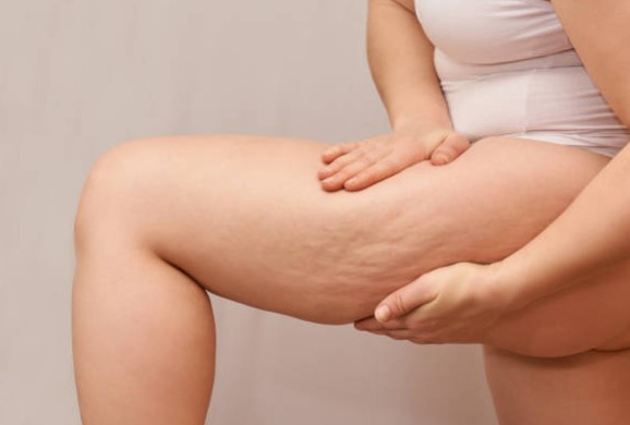 leg